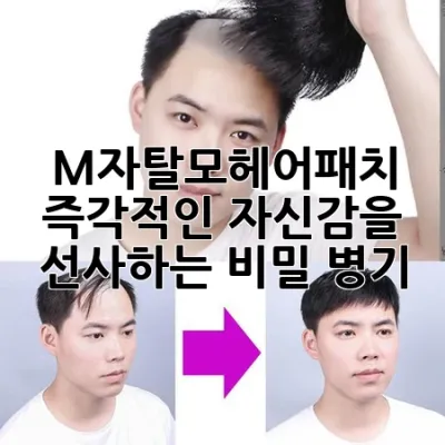 M자탈모헤어패치, 즉각적인 자신감을 선사하는 비밀 병기!